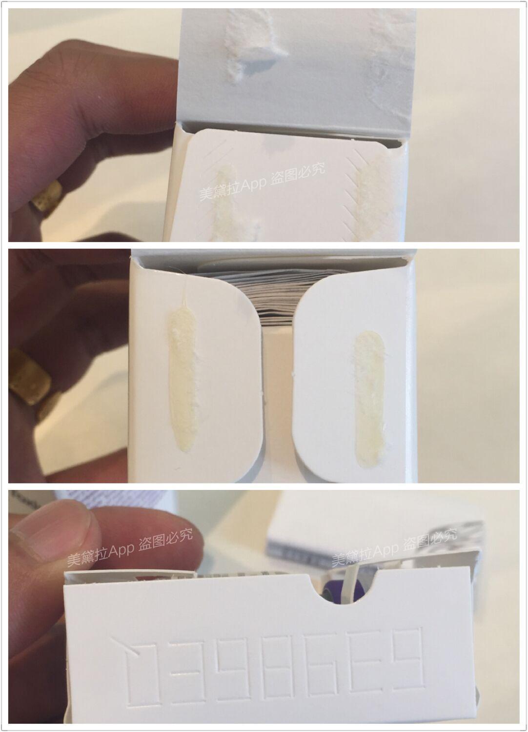 315说真的:教大家鉴别肉毒素和玻尿酸