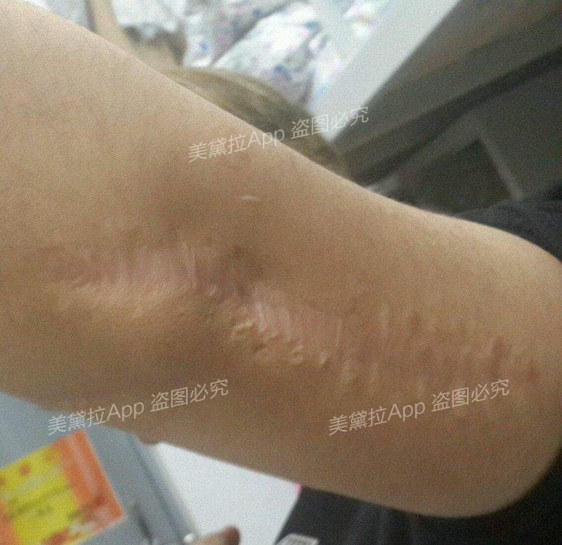 5次,我的愿望实现了